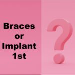 Many patients who want both orthodontic treatments and implants wonder which order the treatment should be done