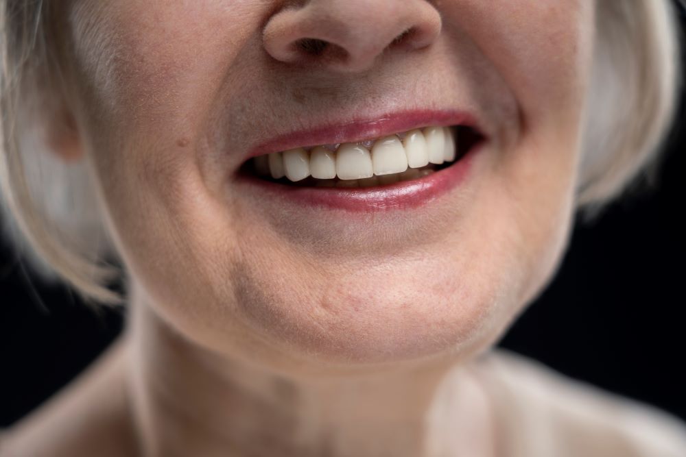 Dental implants teeth are natural looking.